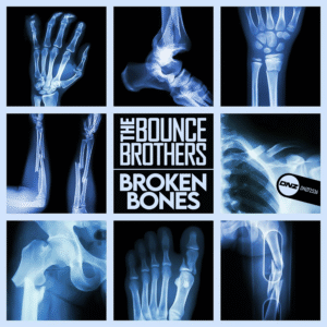 The Bounce Brothers - Broken Bones